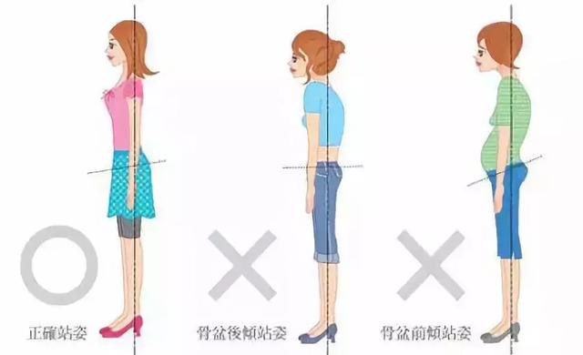 "勺形"是第三大不良站姿,后背挺直但双肩下塌,依旧容易伤害到腰背.